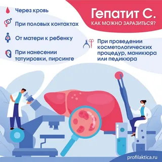 ХВГ 3